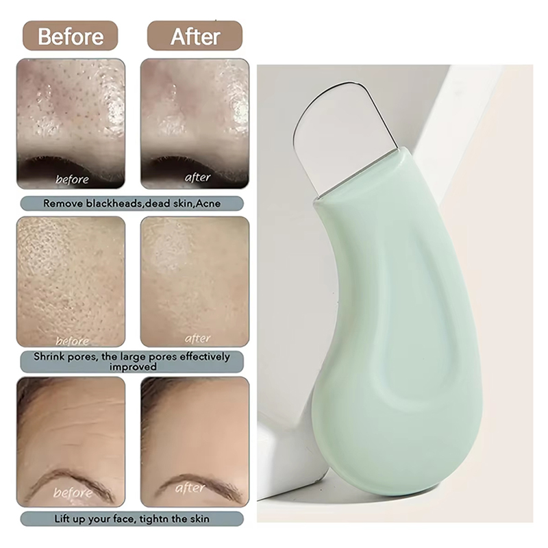 Herramienta de Limpieza Facial - Nasal Aspirator reseña y precio